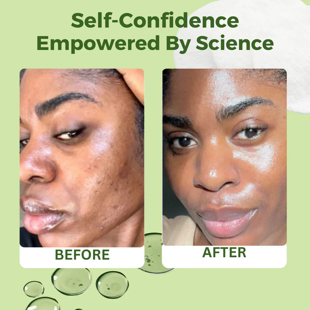 Korean Anti-Aging Toner Pads